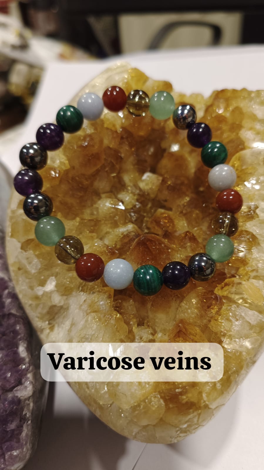 Varicose Veins Bracelet